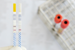 Why Boomers Need to Get Tested for Hepatitis C